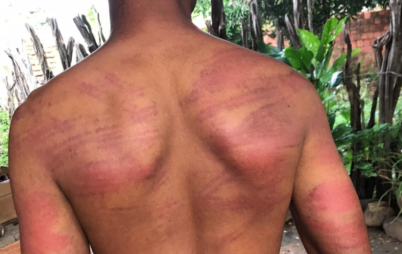 Jovem de comunidade quilombola no PI denuncia agressões e PMs suspeitos são afastados