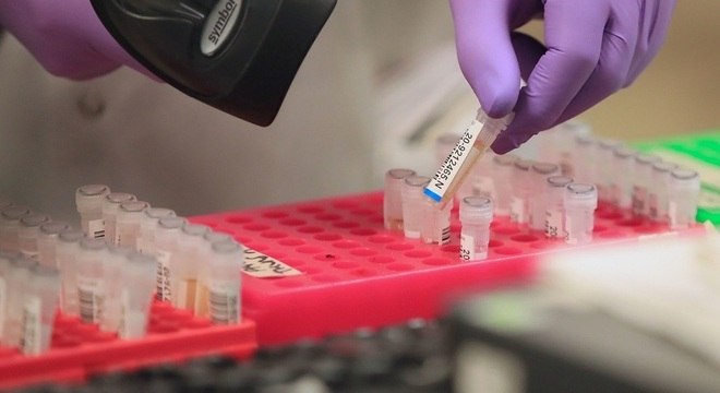 Entenda a diferença entre Covid-19, resfriado e gripe