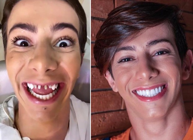 Influenciador digital Davi Mateus choca ao mostrar dentes sem lentes