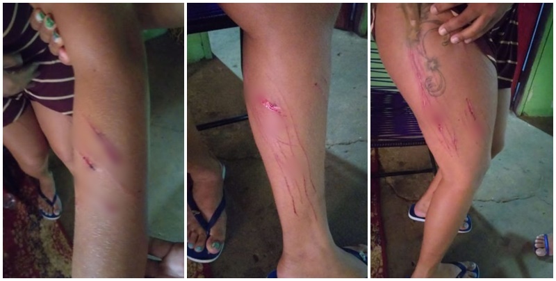 Advogado é preso suspeito de agredir garota de programa em motel no MA
